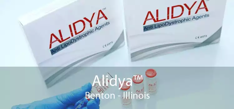 Alidya™ Benton - Illinois